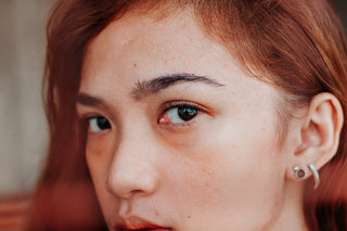 Managing Blemish-Prone Skin Naturally - Hey Honey Beauty