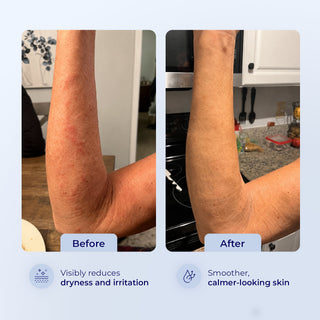 911 PRO GEL - Instant Relief with Propolis - Hey Honey Beauty