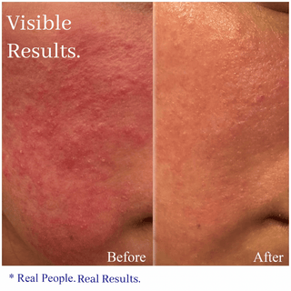 RELAX! - Propolis & Honey Soothing Moisturizer - Hey Honey Beauty