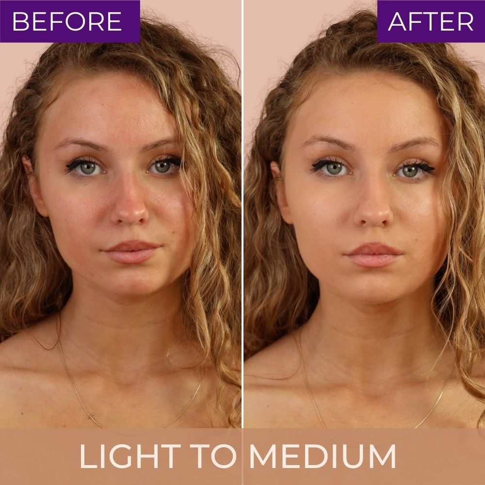 Before & After TRICK & TREAT ROSACEA - CC² Cream Light to Medium Shade from Hey Honey Skincare